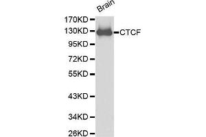 Western Blotting (WB) image for anti-CCCTC-Binding Factor (Zinc Finger Protein) (CTCF) (AA 1-260) antibody (ABIN6215164) (CTCF antibody  (AA 1-260))