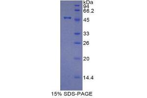 SDS-PAGE (SDS) image for TIMP Metallopeptidase Inhibitor 4 (TIMP4) (AA 10-170) protein (His tag,GST tag) (ABIN1878917) (TIMP4 Protein (AA 10-170) (His tag,GST tag))