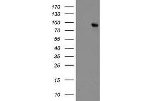 HEK293T cells were transfected with the pCMV6-ENTRY control (Left lane) or pCMV6-ENTRY DPP10 (Right lane) cDNA for 48 hrs and lysed. (DPP10 antibody)