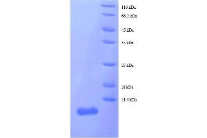 SDS-PAGE (SDS) image for Ribosomal Protein L29 (RPL29) (AA 1-63), (full length) protein (His tag) (ABIN5712634) (RPL29 Protein (AA 1-63, full length) (His tag))