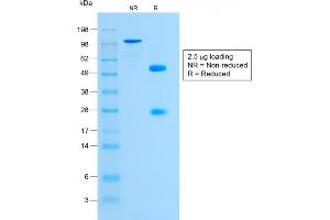SDS-PAGE Analysis Purified Glycophorin A Rabbit Monoclonal Antibody (GYPA/1725R). (Recombinant CD235a/GYPA antibody)