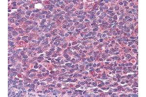 Immunohistochemistry (IHC) image for anti-Calcium/calmodulin-Dependent Protein Kinase II beta (CAMK2B) (AA 1-504) antibody (ABIN614553) (CAMK2B antibody  (AA 1-504))