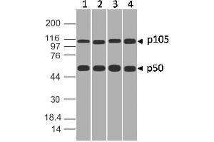 Image no. 1 for anti-Nuclear Factor of kappa Light Polypeptide Gene Enhancer in B-Cells 1 (NFKB1) (AA 1-200) antibody (ABIN5027414) (NFKB1 antibody  (AA 1-200))
