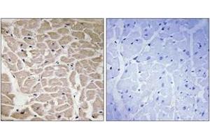 Immunohistochemistry analysis of paraffin-embedded human heart tissue, using Collagen XVI alpha1 Antibody. (COL16A1 antibody  (AA 1121-1170))