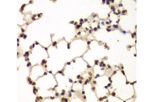 Immunohistochemistry of paraffin-embedded Mouse lung using PRKCB Polyclonal Antibody at dilution of 1:200 (40x lens).