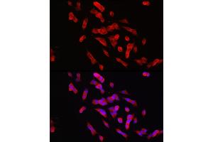 Immunofluorescence analysis of SH-SY5Y cells using PTPN5 Rabbit pAb (ABIN7269705) at dilution of 1:150 (40x lens). (PTPN5 antibody  (AA 360-490))