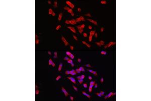 Immunofluorescence analysis of SH-SY5Y cells using PTPN5 Rabbit pAb (ABIN7269705) at dilution of 1:150 (40x lens). (PTPN5 antibody  (AA 360-490))