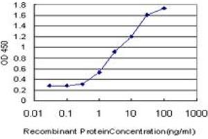 Detection limit for recombinant GST tagged RASGRP4 is approximately 0. (RASGRP4 antibody  (AA 574-673))