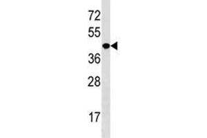 NKX2. (NK2 Homeobox 5 antibody  (AA 2-5))