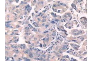 Figure. (Fibronectin antibody  (AA 313-607))