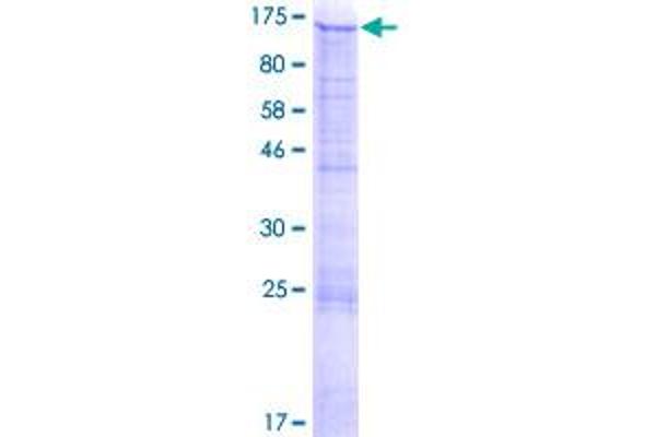 MATN2 Protein (AA 1-937) (GST tag)