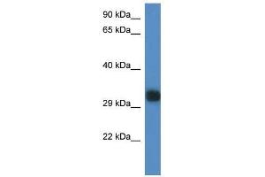Western Blot showing Gm527 antibody used at a concentration of 1. (GM527 antibody  (C-Term))