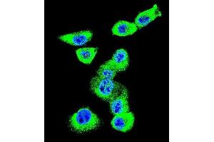 Confocal immunofluorescent analysis of CAV2 Antibody (N-term) (ABIN652586 and ABIN2842393) with MDA-M cell followed by Alexa Fluor 488-conjugated goat anti-rabbit lgG (green).