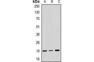 Western blot analysis of NAT13 expression in SKOV3 (A), MCF7 (B), mouse brain (C) whole cell lysates. (NAA50 antibody)