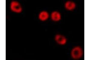 ABIN6277555 staining  HepG2 cells by IF/ICC. (PSMC6 antibody  (Internal Region))