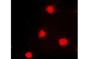 Immunofluorescent analysis of NAT5 staining in A549 cells. (NAT5 antibody)