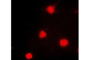 Immunofluorescent analysis of NAT5 staining in A549 cells.