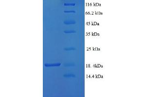 Thymocyte Alloantigen (TTHY) (AA 21-147) protein (His tag)