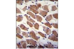 SD7 Antibody (Center) (ABIN655358 and ABIN2844917) immunohistochemistry analysis in formalin fixed and paraffin embedded human skeletal muscle followed by peroxidase conjugation of the secondary antibody and DAB staining. (SAMD7 antibody  (AA 202-230))