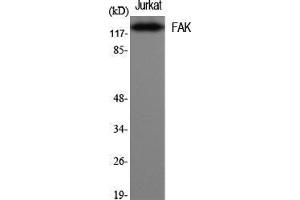 Western Blot (WB) analysis of specific cells using FAK Polyclonal Antibody. (FAK antibody  (Thr446))