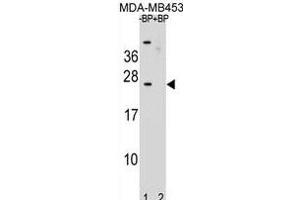Western blot analysis of SSX6 Antibody (Center) Pab (ABIN1881838 and ABIN2839021) pre-incubated without(lane 1) and with(lane 2) blocking peptide in MDA-M cell line lysate. (SSX6 antibody  (AA 62-91))