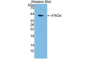 Detection of Recombinant DEFa4, Mouse using Polyclonal Antibody to Defensin Alpha 4, Corticostatin (DEFa4) (DEFA4 antibody  (AA 20-92))