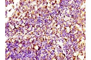 Immunohistochemistry of paraffin-embedded human tonsil tissue using ABIN7169699 at dilution of 1:100 (SIPA1 antibody  (AA 759-927))