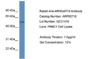 Western Blotting (WB) image for anti-rho GTPase Activating Protein 19 (ARHGAP19) (C-Term) antibody (ABIN2788551) (ARHGAP19 antibody  (C-Term))
