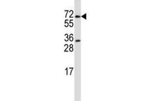 PRMT5 antibody western blot analysis in HL-60 lysate. (PRMT5 antibody  (AA 76-104))