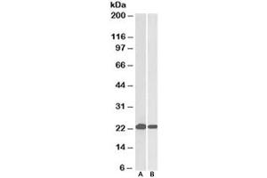 Western blot testing of HeLa [A] and Jurkat [B] lysates with DJ-1 antibody at 0. (PARK7/DJ1 antibody)