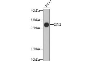 Western blot analysis of extracts of MCF7 cells, using CSN2 antibody (ABIN6133604, ABIN6139112, ABIN6139113 and ABIN6216490) at 1:3000 dilution. (CSN2 antibody  (AA 1-100))