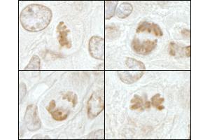 Immunohistochemistry (IHC) image for anti-Kinesin Family Member 2C (KIF2C) (AA 50-100) antibody (ABIN7448647)
