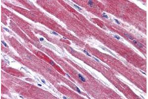 Human Heart: Formalin-Fixed, Paraffin-Embedded (FFPE) (RWDD3 antibody  (C-Term))