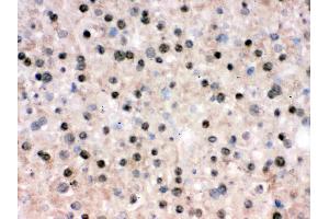 IHC analysis of RbAp48 using anti-RbAp48 antibody . (Retinoblastoma Binding Protein 4 antibody  (C-Term))