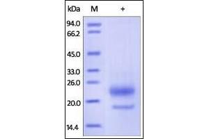 Human R-Spondin 3 (22-146), His Tag on SDS-PAGE under reducing (R) condition. (R-Spondin 3 Protein (RSPO3) (AA 22-146) (His tag))