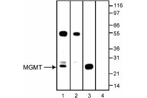 Image no. 2 for anti-O6-Methylguanine-DNA-Methyltransferase (MGMT) antibody (ABIN967567) (MGMT antibody)