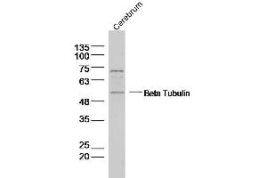 Rat Cerebrum lysates probed with Beta Tubulin Polyclonal Antibody, Unconjugated  at 1:1000 dilution and 4˚C overnight incubation. (TUBB3 antibody  (AA 31-130))