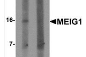 Western blot analysis of MEIG1 in human kidney tissue lysate with MEIG1 antibody at 1 μg/ml in (left) the absence and (right) the presence of blocking peptide.