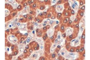 ABIN185169 (4µg/ml) staining of paraffin embedded Human Liver. (SDCBP2 antibody  (C-Term))