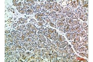 Immunohistochemical analysis of paraffin-embedded human-pancreas, antibody was diluted at 1:200 (MIA2 antibody  (AA 361-410))