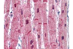 Human Heart: Formalin-Fixed, Paraffin-Embedded (FFPE) (ACTN2 antibody)