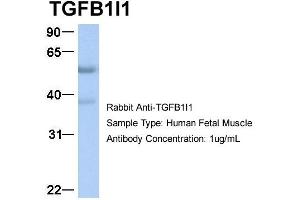 Host:  Rabbit  Target Name:  TGFB1I1  Sample Type:  Human Fetal Muscle  Antibody Dilution:  1. (TGFB1I1 antibody  (Middle Region))