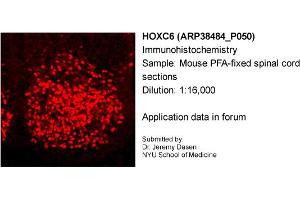 Sample Type: Mouse PFA-fixed spinal cord sectionsPrimary Dilution: 1:16,000 (Homeobox C6 antibody  (C-Term))