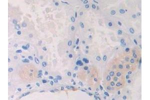 Detection of CAPN2 in Human Kidney Tissue using Polyclonal Antibody to Calpain 2 (CAPN2) (Calpain 2 antibody  (AA 45-514))