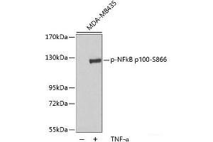 Western blot analysis of extracts of MDA-MB435 cells using Phospho-NFkB p100(S866) Polyclonal Antibody. (NFKB2 antibody  (pSer866))