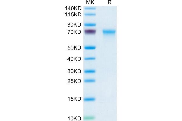 CXCL16 Protein (AA 27-201) (Fc Tag)