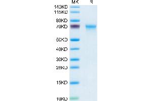 Mouse CXCL16 on Tris-Bis PAGE under reduced condition. (CXCL16 Protein (AA 27-201) (Fc Tag))