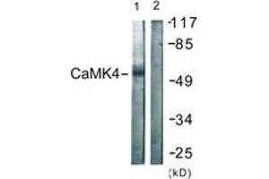 Western blot analysis of extracts from K562 cells, treated with H2O2 100uM 30', using CaMK4 (Ab-196/200) Antibody. (CAMK4 antibody  (AA 166-215))