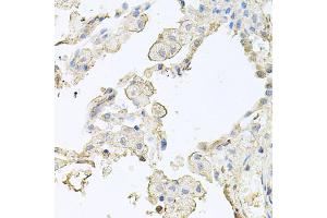Immunohistochemistry of paraffin-embedded human lung using MMRN1 antibody (ABIN5974009) at dilution of 1/100 (40x lens). (Multimerin 1 antibody)
