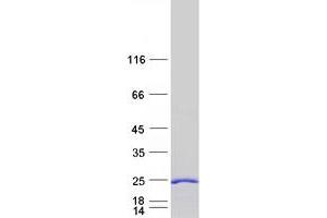 Validation with Western Blot (CEND1 Protein (Myc-DYKDDDDK Tag))